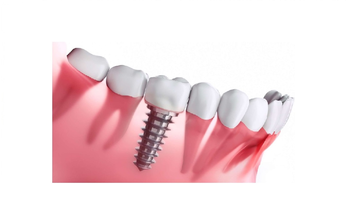 cabinet dentaire kerroucha mohammed fouad